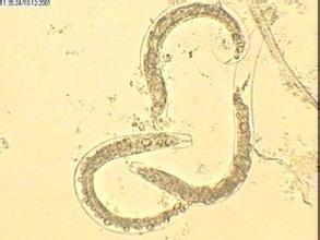 长生不老秘密 线虫揭开长生不老药的秘密