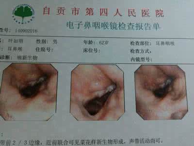 喉癌的早期症状 《中医偏方大全》2012版(肿瘤科)-喉癌