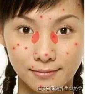 吃激素长痘痘怎么办 脸上长痘痘的原因 脸上起激素痘痘的原因？