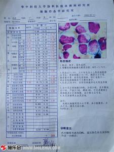 慢性粒细胞白血病 白血病的检查 慢性粒细胞白血病的检查