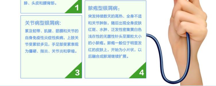 达力士卡泊三醇软膏 使用达力士（卡泊三醇）会有过敏反应吗？