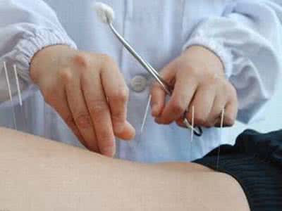 针灸治疗肿瘤 针灸治疗肿瘤 不同肿瘤的针灸方法