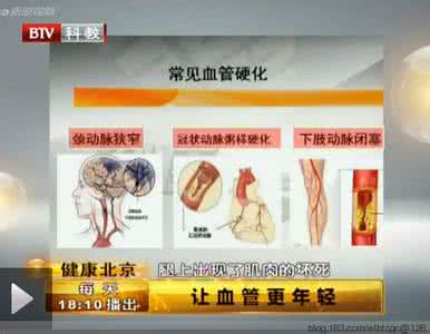 悦本堂 健康常识就 【健康常识】腿疼可能是血管在报警