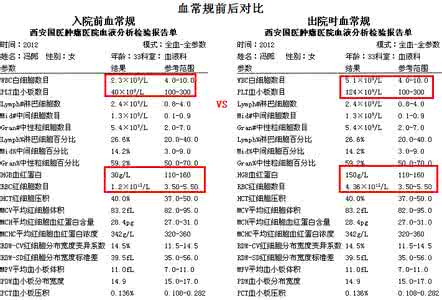 再生障碍性贫血治疗 图文：治疗再生障碍性贫血方