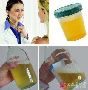 尿液总是发黄 尿液发黄是怎么回事 尿液颜色提示某重病