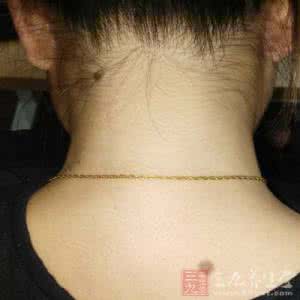 雌激素高的症状 雌激素高的症状 这些表现就是雌激素高