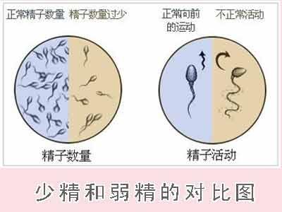 男性不育少精弱精 少精弱精难怀孕，男性如何养精