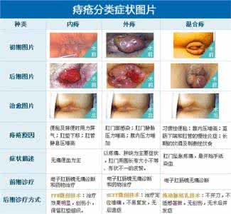 痣苍症状 痣苍是怎么形成的 痣苍的症状与治疗