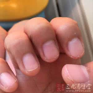 脚后跟麻木怎么回事 脚后跟麻木 脚后跟麻是怎么回事 是什么导致脚后跟麻木