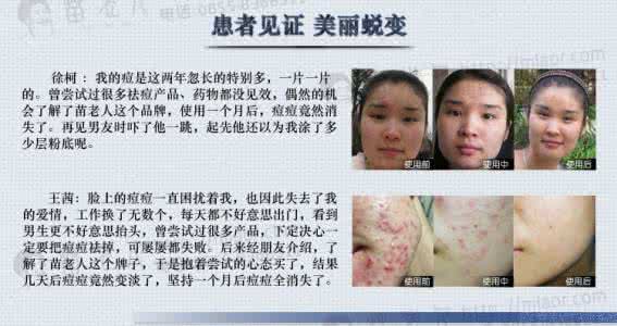 睫毛增长液主要功效 祛痘液多少钱,主要功效,如何使用