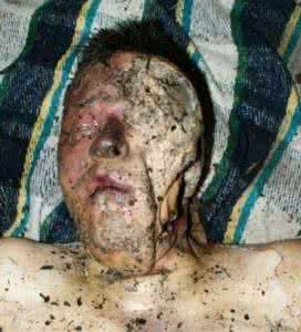 为什么人死后会腐烂 人死后为什么会腐烂?