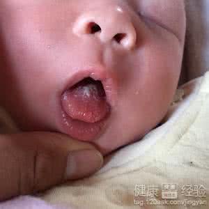舌苔厚而白是怎么回事 小孩舌苔厚 小孩舌苔厚发白是怎么回事呢