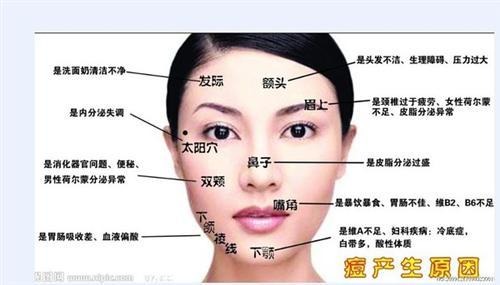 右脸颊长痘痘原因 脸颊长痘痘的原因 有脸长痘痘原因？