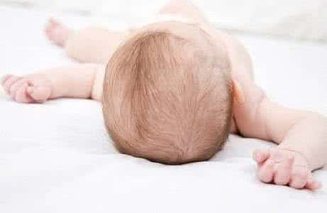 揭密鱼鳞病头发少 新生儿头发问题的揭密