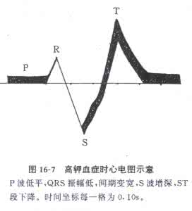高钾血症的处理措施 高钾血症