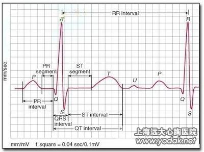教你如何看懂心电图 如何看心电图 教你如何看懂心电图