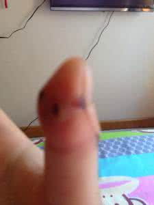 被打过疫苗的猫咬了 被被猫咬了要打疫苗吗？