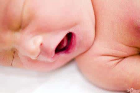 疼痛的护理措施 中老年乳房护理 中老年癫痫护理措施有哪些呢