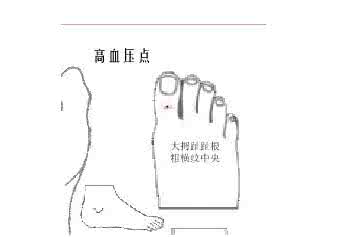 每天早晨喝一杯淡盐水 高血压担心吃盐过多 每天喝一杯它助排钠降压