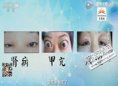 健康之路风湿关节炎 五官里的风湿信号 健康之路 | 五官里的风湿信号