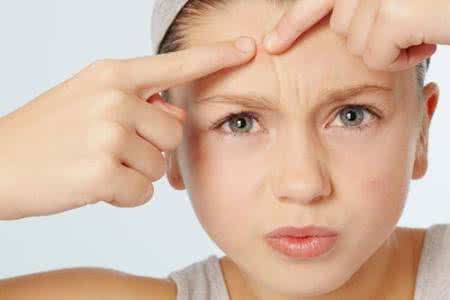 额头祛痘小妙招 额头祛痘 额头祛痘小窍门