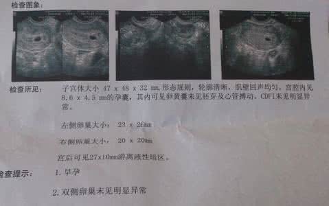 怎样治愈妊娠纹 怀孕晚期吃什么 怀孕中晚期心理状态