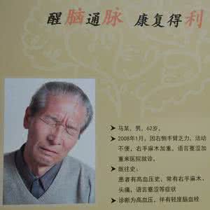 补阳还五汤的加减配方 补阳还五汤加减治疗中风后遗症80例临床观察