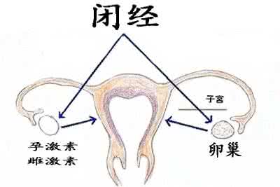 卵巢早衰闭经怎么办 卵巢性闭经 卵巢性闭经的原因有哪些