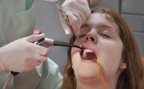 为什么经期不能拔牙 经期为什么不能拔牙 女人拔牙需谨慎