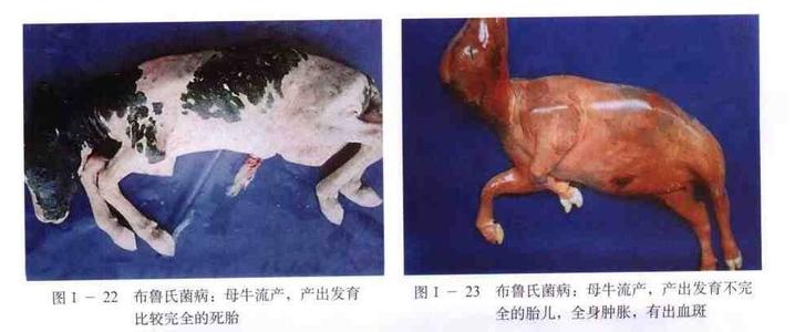 布鲁氏菌病可治愈吗 布鲁斯氏菌病