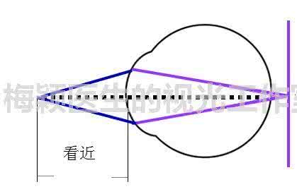 调节超前与调节滞后 调节滞后与近视进展的思考之二：先有鸡还是先有蛋？