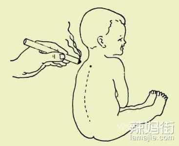 艾灸身柱长高了很多 艾灸身柱长高了很多 孩子不生病的秘密——身柱灸