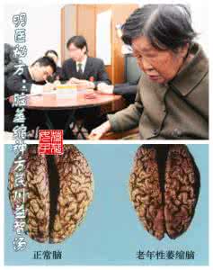 糖尿病特效秘验方 转载 脑萎缩病特效验方