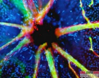 令人惊异的海底世界 人体探秘：令人惊异的人体显微照片