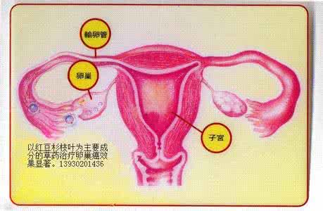 卵巢畸胎瘤 卵巢畸胎瘤 带大家了解卵巢畸胎瘤