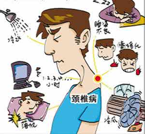 颈椎病常见症状 颈椎病常见症状 常被误诊的6种颈椎病症状