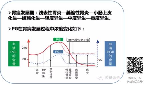 胃蛋白酶原1偏低 胃蛋白酶原