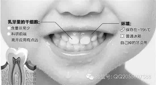 乳牙救命 乳牙救命 孩子乳牙掉了，别再傻傻丢掉!储存下来可救命!