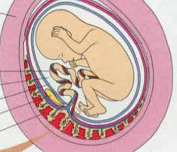 胎盘植入会有什么感觉 胎盘植入的症状