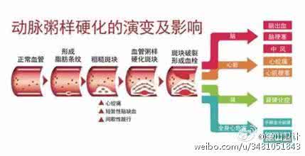 甲状腺癌症死亡率 专家称动粥疾病超过癌症成中国死亡率最高疾病