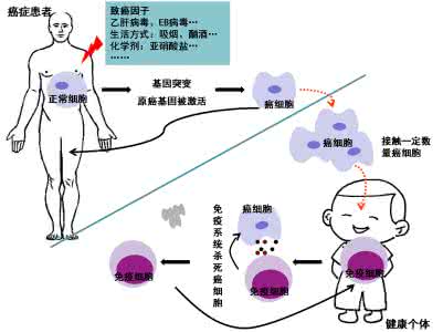 会传染的癌症 会传染的癌症，罪魁祸首竟然是它！一定要看！