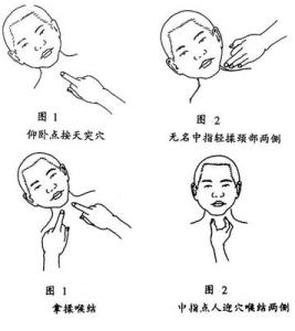 慢性咽炎的治疗方法 用按摩的方法来治疗慢性咽炎