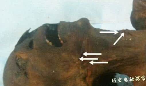 拉美西斯二世木乃伊 CT扫描木乃伊发现拉美西斯三世神秘死因（图）