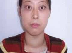 甲亢能治愈吗 甲亢