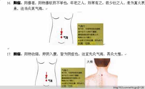 脑血栓属于大病吗 中医治大病——简易艾灸/脑血栓偏方/超难找的偏方