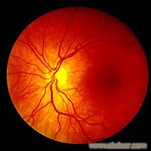 视神经萎缩的治疗方法 视神经萎缩效方