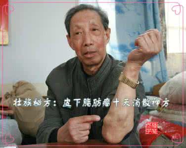 名医专治狐臭 名医神方:专治皮下脂肪瘤!