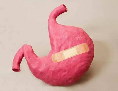 胃癌案例 全球每年新发生胃癌近100万例 近半数发生在中国