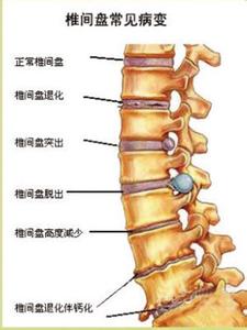 骨盆结构解剖图 躯干骨的连结结构解剖（图文详解）