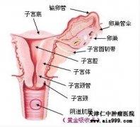 内痔的治疗方法有哪些 阴道癌 阴道癌的治疗方法有哪些